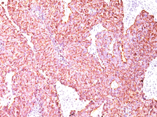 Anti-Chromogranin A antibody [CGA/414] used in IHC (Paraffin sections) (IHC-P). GTX34593
