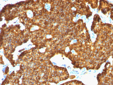 Anti-Chromogranin A antibody [SPM553] used in IHC (Paraffin sections) (IHC-P). GTX34594