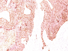 Anti-Chromogranin A antibody [SPM339] used in IHC (Paraffin sections) (IHC-P). GTX34595