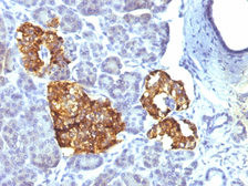 Anti-Chromogranin A antibody [CHGA/777] used in IHC (Paraffin sections) (IHC-P). GTX34598