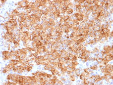 Anti-Chromogranin A antibody [CHGA/1773R] used in IHC (Paraffin sections) (IHC-P). GTX34602