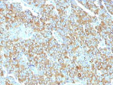 Anti-Chromogranin A antibody [PHE5] used in IHC (Paraffin sections) (IHC-P). GTX34605
