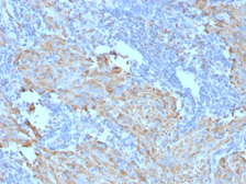 Anti-c-Kit antibody [C117/370] used in IHC (Paraffin sections) (IHC-P). GTX34606