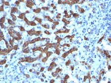 Anti-CPS1 antibody [CPS1/1022] used in IHC (Paraffin sections) (IHC-P). GTX34613