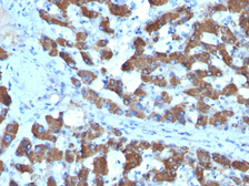 Anti-CPS1 antibody [SPM615] used in IHC (Paraffin sections) (IHC-P). GTX34614