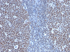 Anti-Cyclin B1 antibody [SPM619] used in IHC (Paraffin sections) (IHC-P). GTX34616