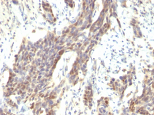 Anti-Cyclin D1 antibody [CCND1/809] used in IHC (Paraffin sections) (IHC-P). GTX34617