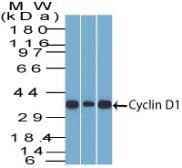 Anti-Cyclin D1 antibody [DCS-6] used in Western Blot (WB). GTX34618