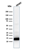Anti-Cytochrome C antibody [CYCS/1010] used in Western Blot (WB). GTX34621