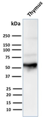 Anti-Cytokeratin 10 antibody [LH2] used in Western Blot (WB). GTX34623