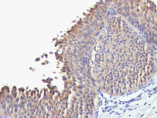 Anti-Cytokeratin 10 antibody [SPM623] used in IHC (Paraffin sections) (IHC-P). GTX34627