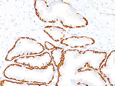 Anti-Cytokeratin 14 antibody [SPM263] used in IHC (Paraffin sections) (IHC-P). GTX34629