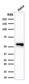 Anti-Cytokeratin 7 antibody [SPM270] used in Western Blot (WB). GTX34656