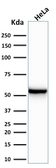 Anti-Cytokeratin 7 antibody [KRT7/760] used in Western Blot (WB). GTX34659