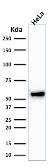 Anti-Cytokeratin 7 antibody [KRT7/1198] used in Western Blot (WB). GTX34660