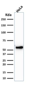 Anti-Cytokeratin 7 antibody [KRT7/1198] used in Western Blot (WB). GTX34660