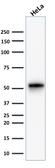 Anti-Cytokeratin 7 antibody [KRT7/1499R] used in Western Blot (WB). GTX34661