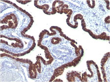 Anti-Cytokeratin 7 antibody [OV-TL12/30] used in IHC (Paraffin sections) (IHC-P). GTX34662