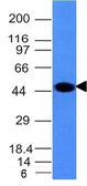 Anti-Cytokeratin 8 antibody [H1] used in Western Blot (WB). GTX34663
