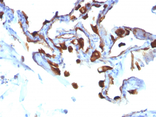 Anti-Cytokeratin 8 antibody [KRT8/803] used in IHC (Paraffin sections) (IHC-P). GTX34671
