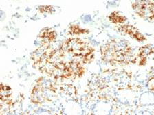Anti-DC-SIGN antibody [C209/1781] used in IHC (Paraffin sections) (IHC-P). GTX34673