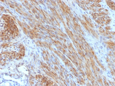 Anti-Desmin antibody [DES/1711] used in IHC (Paraffin sections) (IHC-P). GTX34674
