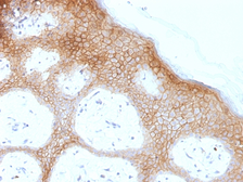 Anti-Desmoglein 1 antibody [DSG1/1733] used in IHC (Paraffin sections) (IHC-P). GTX34675