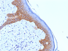 Anti-Desmoglein 3 antibody [5G11] used in IHC (Paraffin sections) (IHC-P). GTX34676