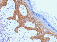 Anti-Desmoglein 3 antibody [DSG3/1535] used in IHC (Paraffin sections) (IHC-P). GTX34677