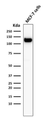 Anti-E-Cadherin antibody [4A2] used in Western Blot (WB). GTX34679