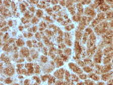 Anti-Elastase 3B antibody [CELA3B/1257] used in IHC (Paraffin sections) (IHC-P). GTX34687
