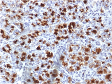 Anti-Elastase 3B antibody [CELA3B/1757] used in IHC (Paraffin sections) (IHC-P). GTX34688
