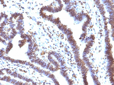 Anti-EMI1 antibody [EMI1/1176] used in IHC (Paraffin sections) (IHC-P). GTX34689