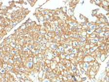 Anti-EpCAM antibody used in IHC (Paraffin sections) (IHC-P). GTX34690