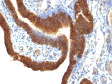 Anti-EpCAM antibody [SPM491] used in IHC (Paraffin sections) (IHC-P). GTX34693