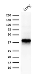 Anti-EpCAM antibody [EGP40/1373] used in Western Blot (WB). GTX34695