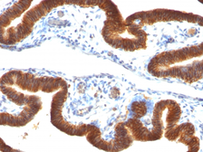 Anti-EpCAM antibody [SPM134] used in IHC (Paraffin sections) (IHC-P). GTX34699