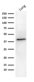 Anti-EpCAM antibody [MOC-31] used in Western Blot (WB). GTX34700