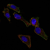 Anti-EpCAM antibody [EGP40/826] used in Immunocytochemistry/ Immunofluorescence (ICC/IF). GTX34704