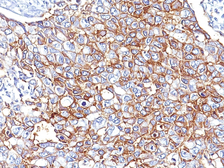 Anti-EpCAM antibody [PAN-EpCAM (Cocktail)] used in IHC (Paraffin sections) (IHC-P). GTX34706