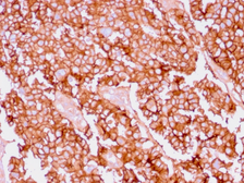 Anti-EpCAM antibody [EGP40/1556R] used in IHC (Paraffin sections) (IHC-P). GTX34708