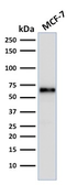 Anti-Estrogen Receptor alpha antibody [ER506] used in Western Blot (WB). GTX34710