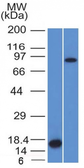 Anti-Factor XIIIa antibody [F13A1/1448] used in Western Blot (WB). GTX34714