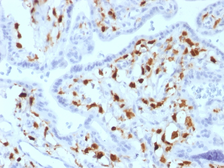 Anti-Factor XIIIa antibody [SPM180] used in IHC (Paraffin sections) (IHC-P). GTX34715