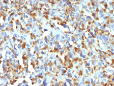 Anti-Factor XIIIa antibody [F13A1/1683] used in IHC (Paraffin sections) (IHC-P). GTX34716