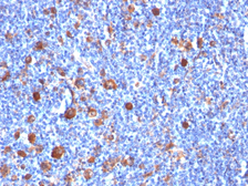 Anti-Fascin 1 antibody [SPM133] used in IHC (Paraffin sections) (IHC-P). GTX34719