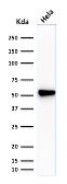 Anti-Fascin 1 antibody [SPM133] used in Western Blot (WB). GTX34719