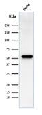 Anti-Fascin 1 antibody [FSCN1/418] used in Western Blot (WB). GTX34720