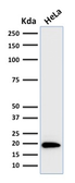 Anti-Ferritin Light Chain antibody [FTL/1386] used in Western Blot (WB). GTX34722