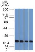 Anti-Ferritin Light Chain antibody [FTL/1386] used in Western Blot (WB). GTX34722